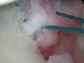 video_thumb